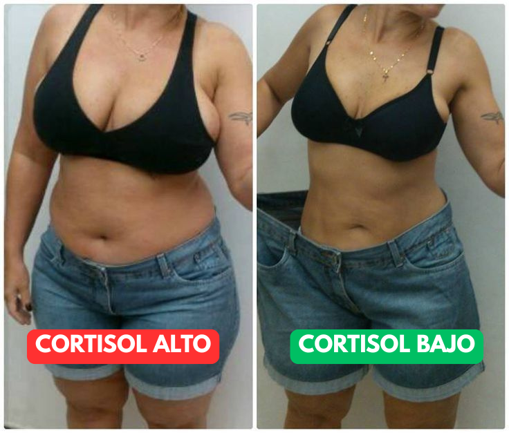 Cortisol y grasa abdominal